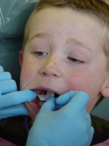 El 86% de los niños ha acudido al dentista alguna vez